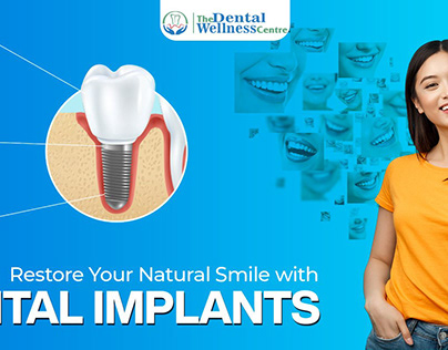 Restore Your Smile with Dental Implants on