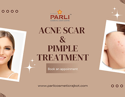 Acne Scar & Pimple