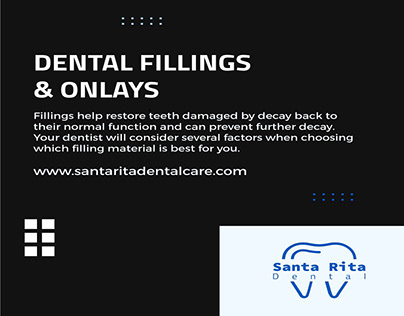 Dental Fillings & Onlays