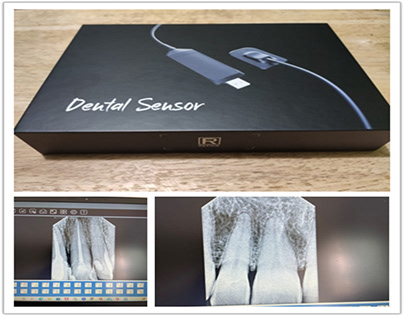 Refine Medical dental sensor R1/R2