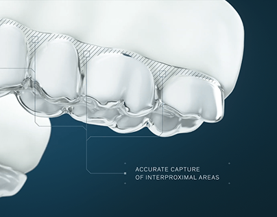 Next Generation - Reveal Clear Aligners