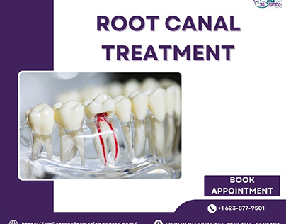 Root Canal Treatment in Glendale