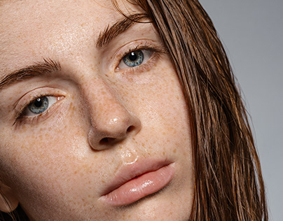 Freckles beauty photoshoot