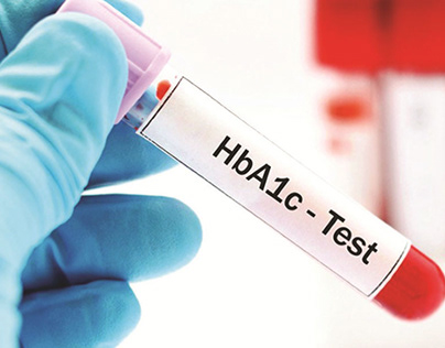 HbA1c Test (Hemoglobin A1C) in Gurgaon | Healthians
