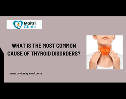 Causes of thyroid disorders