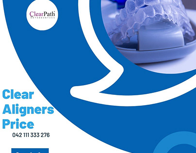 Clear Aligners Price