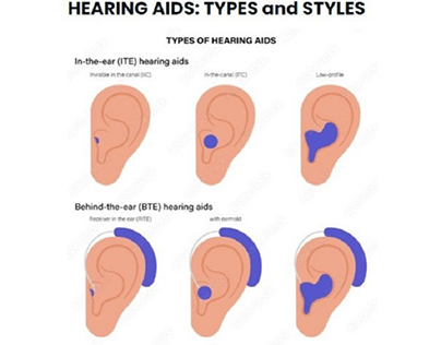 Different Types and Styles of Hearing Aids