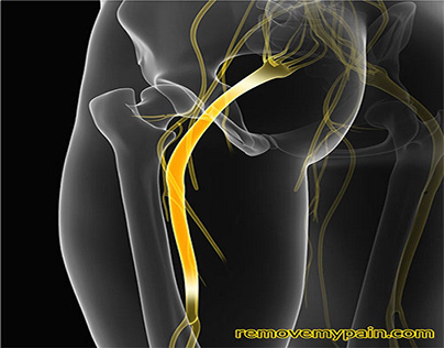Back Pain Which Should Not To Be Ignored