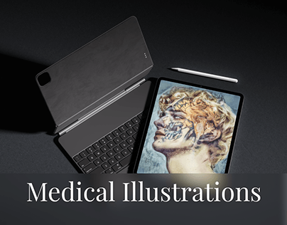 Medical illustrations and 3d visualizations