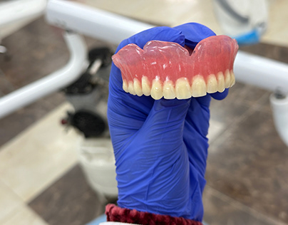 Project thumbnail - Removable Single denture