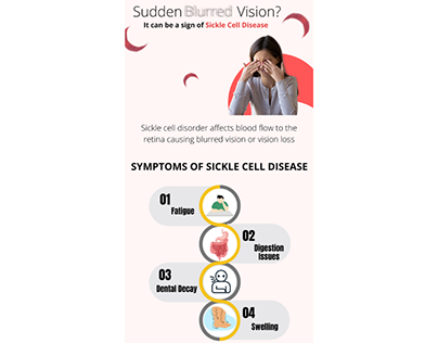 Sudden Blurred Vision by Sickle Cell Disease