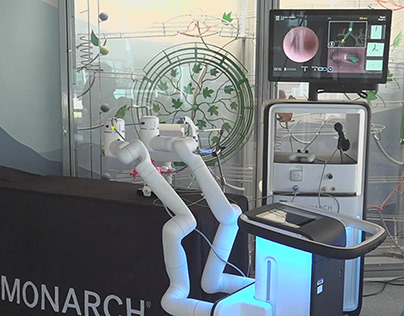 Breakthrough Lung Cancer Diagnostic Robot Unveiled
