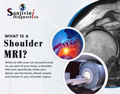 MRI in Chandigarh-sanjivinidiagnostic