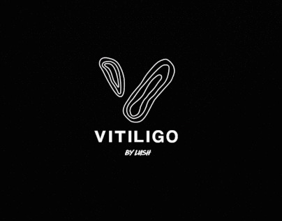 Lush Vitiligo Campaign