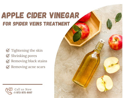 apple cider vinegar spider veins