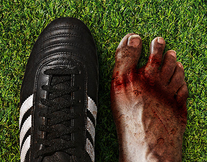 SOCCER CLEAT & INJURED FOOT PHOTO MANIPULATION