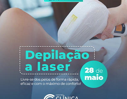 Depilação a laser 2 | Clinica Popular