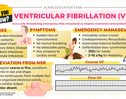 Venticular fibrillation (VF)