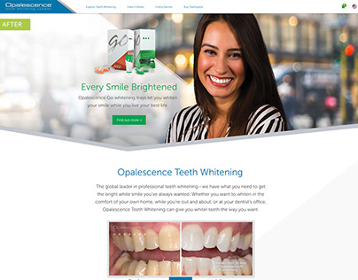 Opalescence Teeth Whitening | Website Redesign