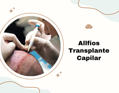Allfios transplante capilar
