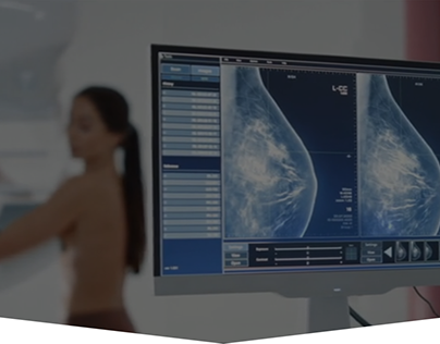 Breast Cancer Detection With 3D Mammography