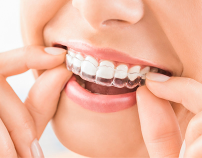 The right orthodontic treatment for you.
