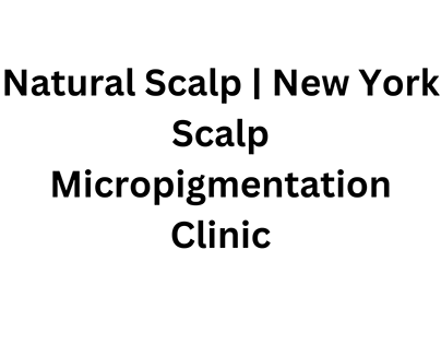 Natural Scalp | New York Scalp Micropigmentation Clinic