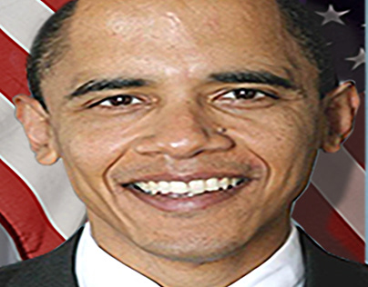 Obama Hair loss