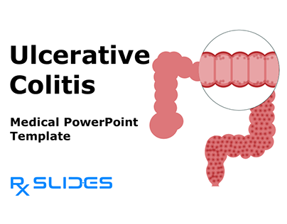 Ulcerative Colitis PowerPoint Presentation Template