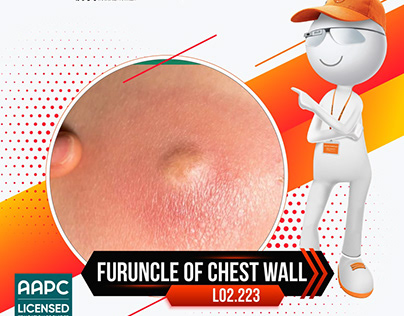 Furuncle of chest wall ICD-10 code L02.223