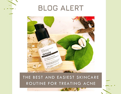 anti acne creams