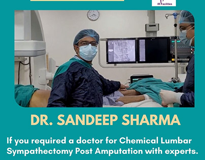 Chemical Lumbar Sympathectomy Post Amputation