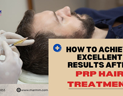 HowTo Achieve Excellent ResultsAfter PRP Hair Treatment