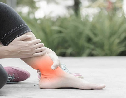 How to Treat Edema-Related Swollen Feet
