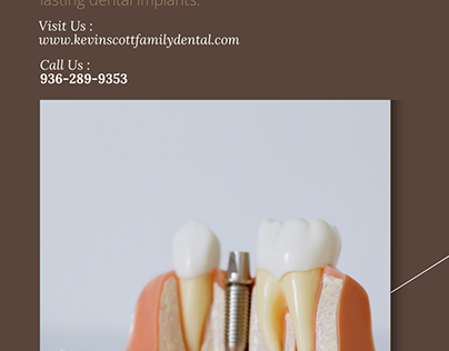 Best dental Implants Montgomery TX