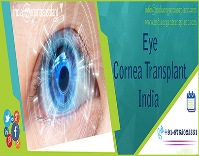 Affordable Eye Transplant Cost in India for an African