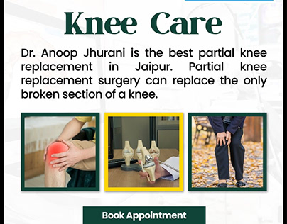 The Benefits of Partial Knee Replacement Surgery