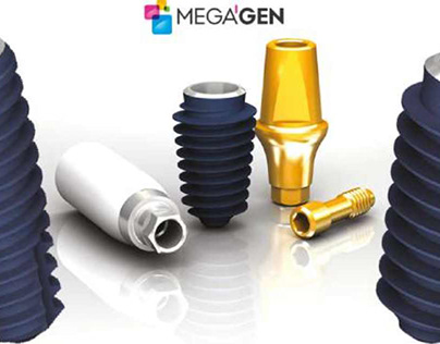 Trụ Implant Megagen Hàn Quốc có tốt không?