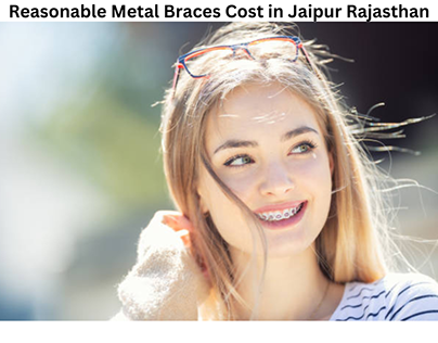 Reasonable Metal Braces Cost in Jaipur Rajasthan