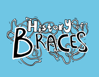 History Of Braces - Timeline