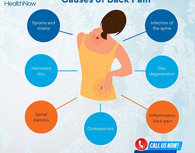 Some Common Causes of Back Pain