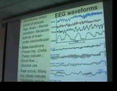 EEG – Sleep Part 1 – Dr Sanjoy Sanyal