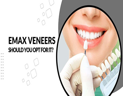 Emax Veneers: Should You Opt for It?