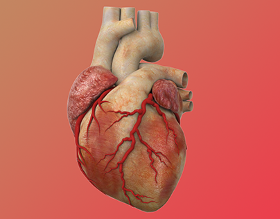 Heart Stent Insertion
