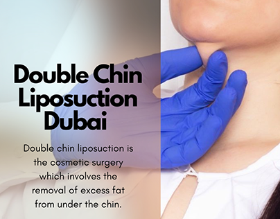 double chin liposuction in dubai