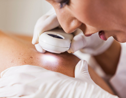 Why Visiting a Dermatologist to Treat Acne Makes Sense