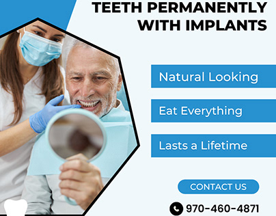 Dental Implants In Windsor, CO.