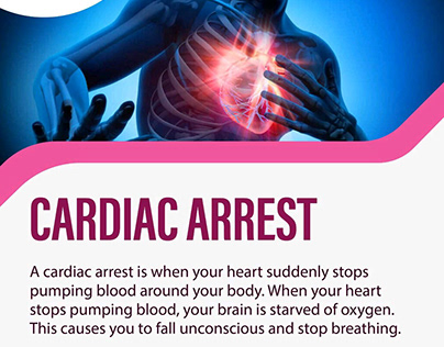 Know about Cardiac arrest | Dr. Ganesh Krishnan Iyer