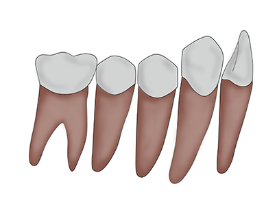 Ilustração Arcada Dentária