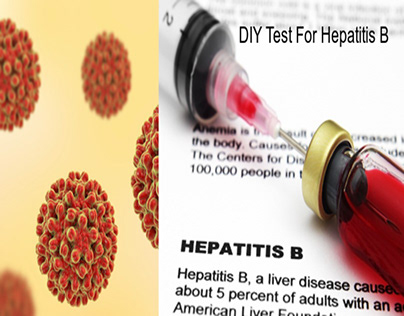 Diy Test For Hepatitis B